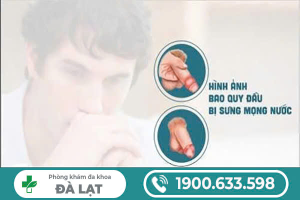 Hình ảnh minh họa